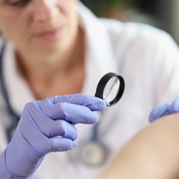 Skin Cancer Check-Up