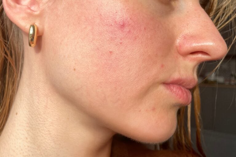 Seasonal Breakouts